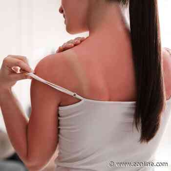 Sunburned? A Celeb Esthetician’s Secret to Prevent Peeling