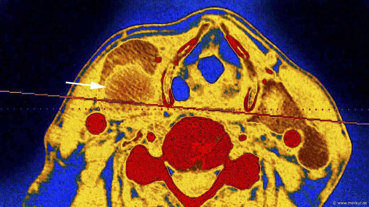 Arzt sagte, es sei nur „Angst“ – dann bekommt Frau eine Diagnose, die ihr Leben veränderte