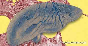 There’s a Fatty Liver Epidemic. AI Could Help Get Ahead of It
