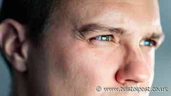 NHS solar eclipse advice to anyone with dots, lines or flashes in their eye