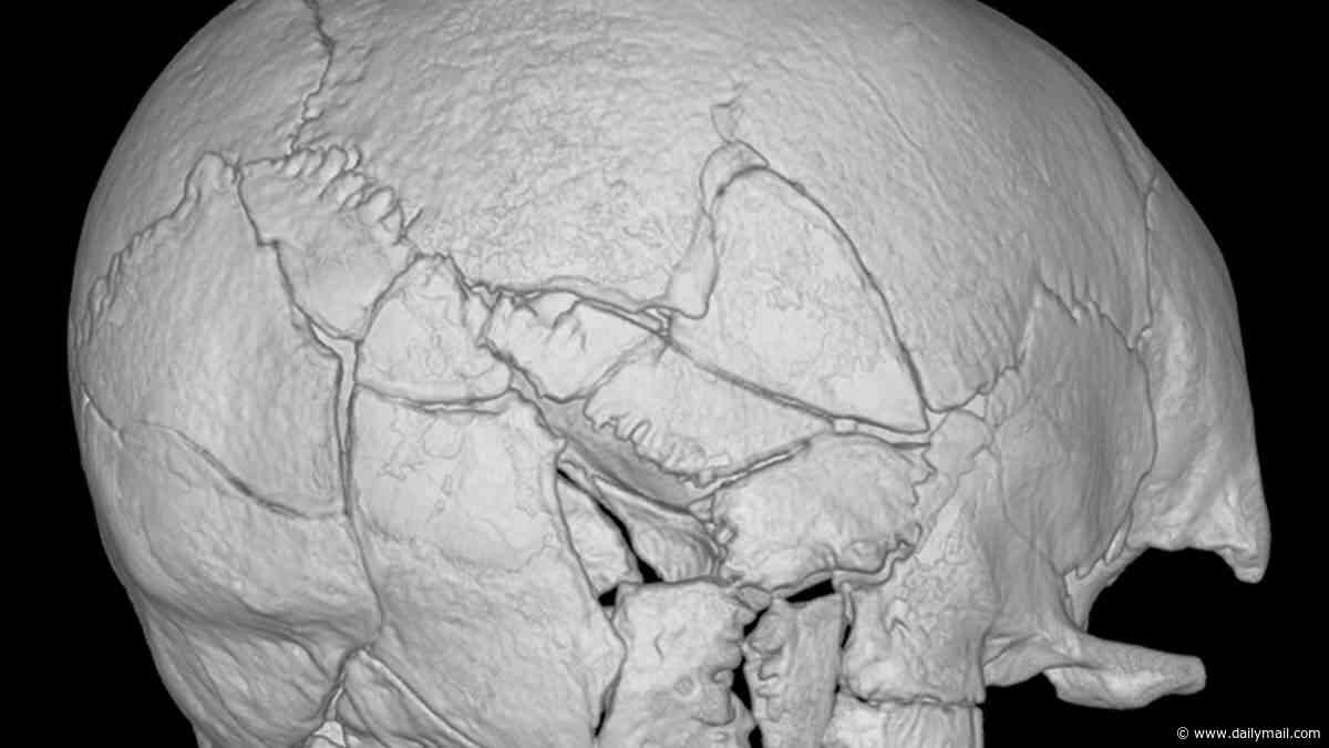 Medieval missile: Skeleton found at Scottish castle is first confirmed victim of a trebuchet attack