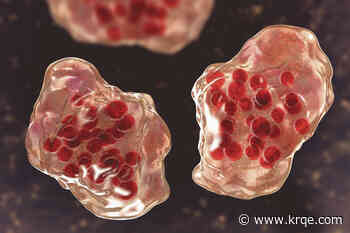 Adult tests positive for measles in Eddy County
