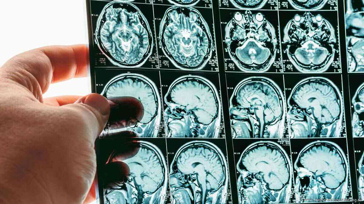 Kann Abendessen zur falschen Uhrzeit das Demenz-Risiko erhöhen? Neurologe äußert sich