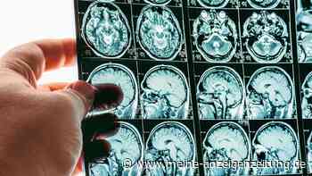 Kann Abendessen zur falschen Uhrzeit das Demenz-Risiko erhöhen? Neurologe äußert sich