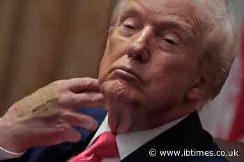 Trump Vein Diagnosis Turns Spotlight on Chronic Venous Insufficiency in Millions of Aging Americans