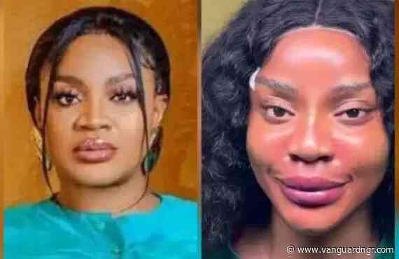 Uche Ogbodo reveals ‘new face’ after non-surgical procedure