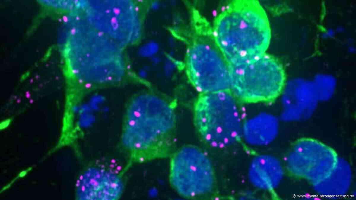 Parkinson-Protein blockiert Zellreinigung – und könnte Nervenzellen früh schädigen