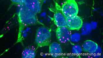 Parkinson-Protein blockiert Zellreinigung – und könnte Nervenzellen früh schädigen