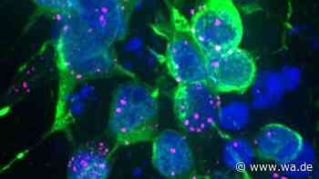 Parkinson-Protein blockiert Zellreinigung – und könnte Nervenzellen früh schädigen