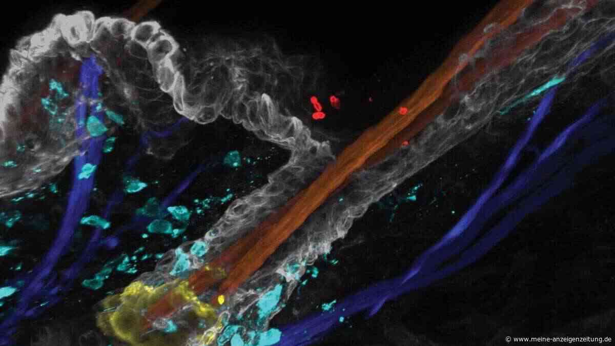 Dieser „Killerpilz“ befällt Kliniken: Candida auris versteckt sich unbemerkt in unserer Haut