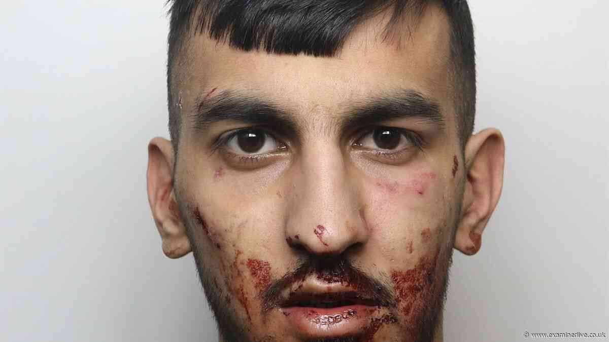 Driver stripped number plates after 100mph crash left teen without a leg