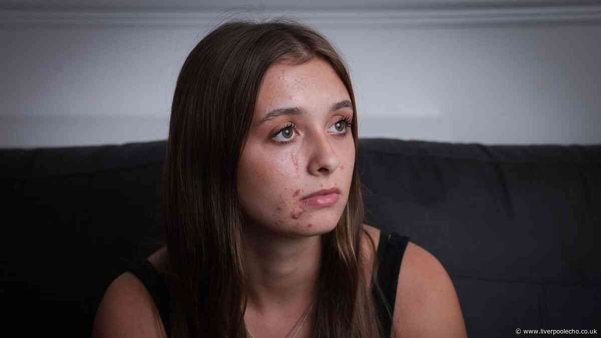 Tranmere woman's life haunted by the same question strangers always ask her: what happened?