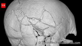 160 plus fractures found in Scottish castle skeleton may be first confirmed trebuchet death