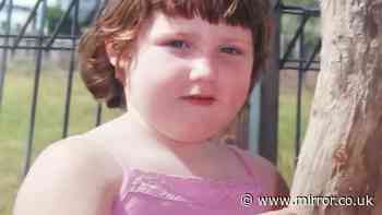 ‘I weighed 14st aged nine - losing 15st showed the real battle was after the weight came off'