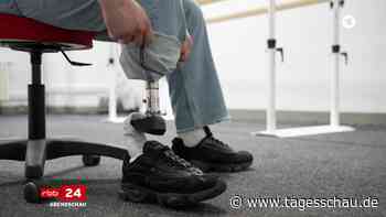 Ukrainischer Veteran: Vom Patienten zum Prothesenmacher