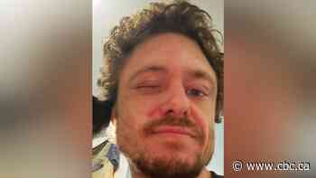 Missing 36-year-old man last seen in Winnipeg's Centennial area