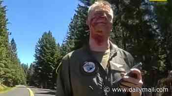 Extraordinary moment bloodied fighter pilot casually greets police officer moments after miracle escape from F-18 Hornet jet that ploughed into Washington mountainside