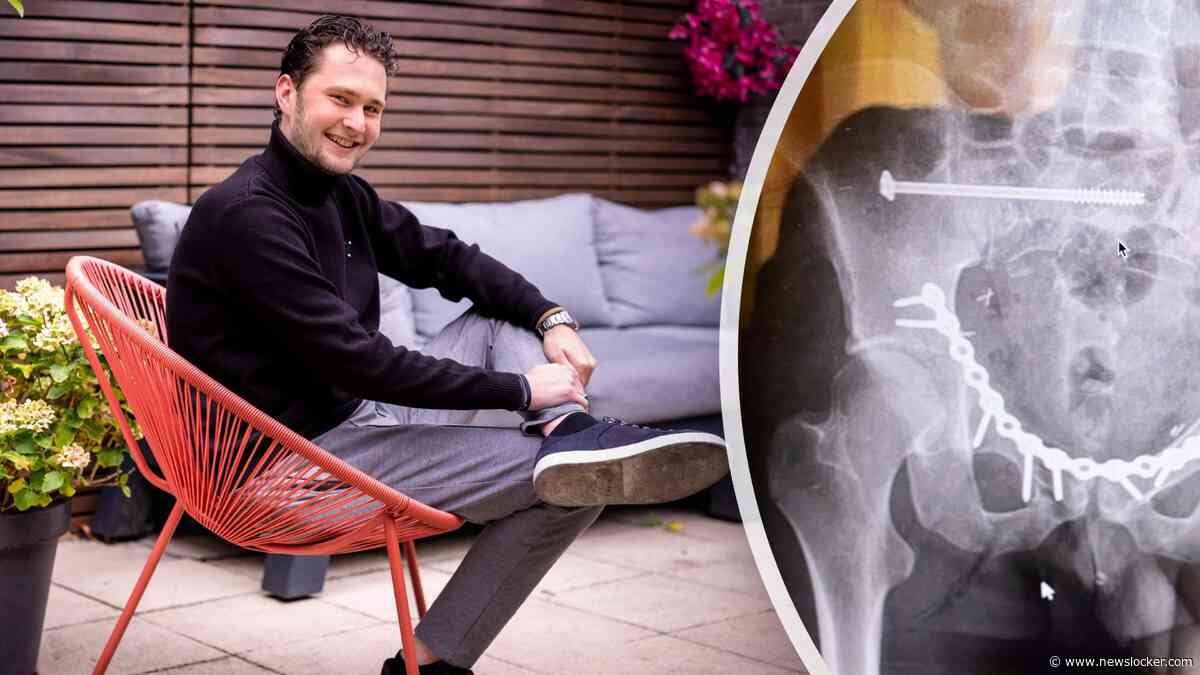 Max raakte bij een scooterongeluk bekneld onder een auto: ’De helm heeft mijn leven gered’