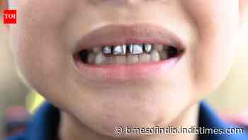 Who are ‘silver tooth kids’ and why is the internet calling them ‘bad’?