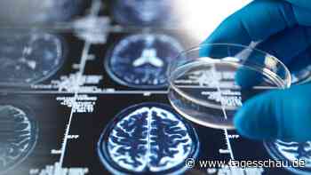 3D-Hirngewebemodell soll Alzheimer-Forschung verbessern