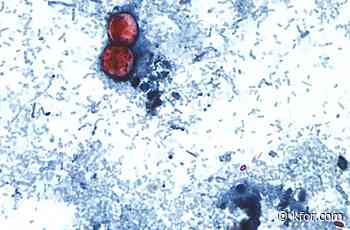 Cyclospora outbreaks with no confirmed sources grow: FDA