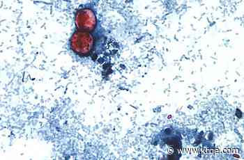 Cyclospora outbreaks with no confirmed sources grow: FDA