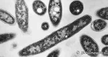 Toronto Public Health investigating legionnaires’ disease outbreak near downtown core