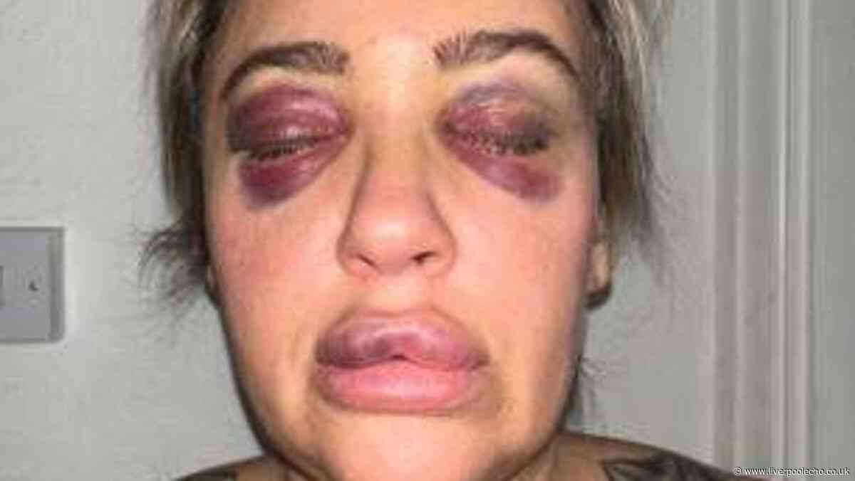 Mum said 'I believed they were the last moments of my life' after thug attacked her