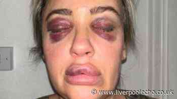Mum said 'I believed they were the last moments of my life' after thug attacked her