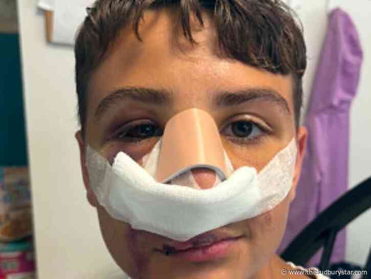 Hanmer mother says attack on son ‘a nightmare’