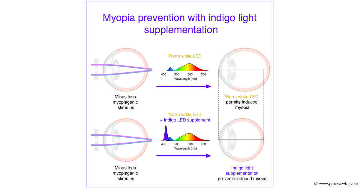 Restoring a Missing Slice of Sunshine to Indoor Light May Help Prevent Myopia