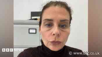 Mum warns of 'botched' £150 filler that cost £700 to fix