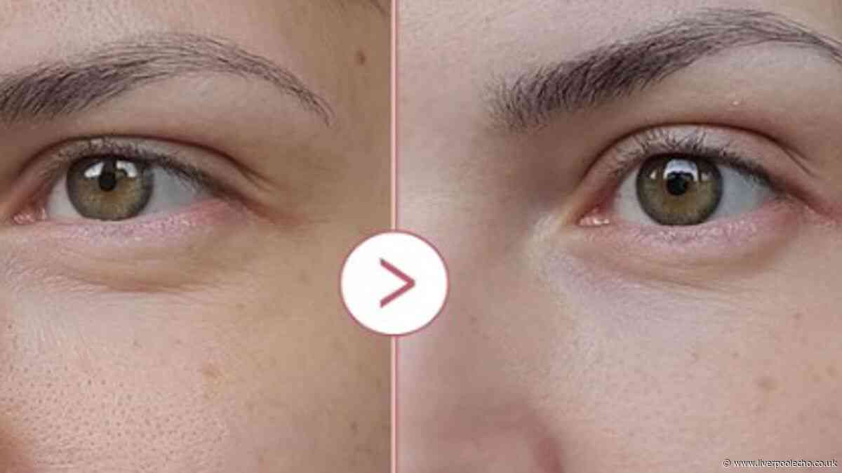 Reduced £10 Medicube eye serum 'fixes baggy eyes and fine lines'