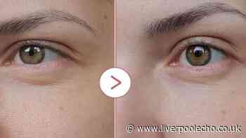 Reduced £10 Medicube eye serum 'fixes baggy eyes and fine lines'