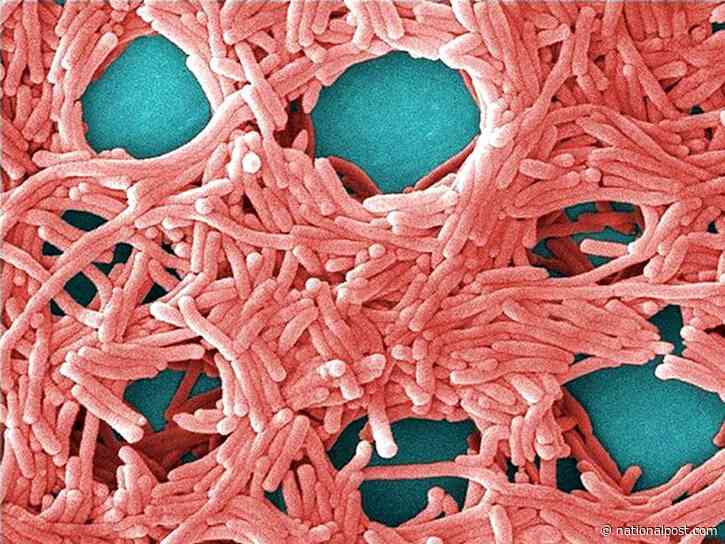 Legionnaires' disease causes and symptoms as health officials investigate Toronto outbreak