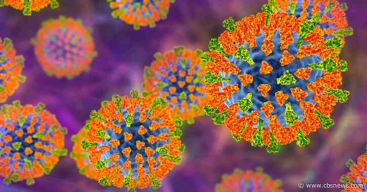 New measles case confirmed in unvaccinated metro Atlanta resident, Georgia health officials say