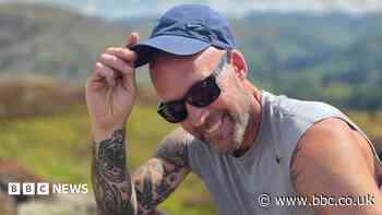 'Hair loss slowly chipped away at my confidence'