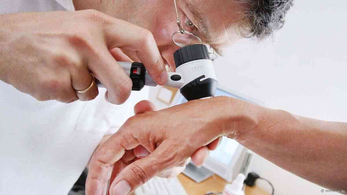 Blutzellen als Therapie-Wegweiser: Forscher entdecken Immunmuster bei Hautkrebs