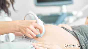 Expectant Ontario moms are travelling hours for routine ultrasounds amid sonographer shortage