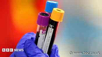 Hospital emergency blood testing cover withdrawn