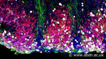 New human brain model sheds light on how inflammation may influence early brain development