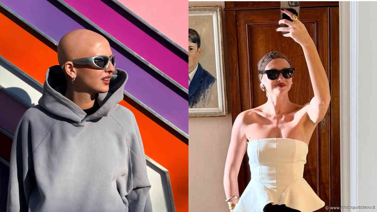“Ho l’alopecia, ma non ho mai indossato parrucche. Dopo l’adolescenza ho sentito la necessità di mostrarmi”: la storia di Eugenia Longo