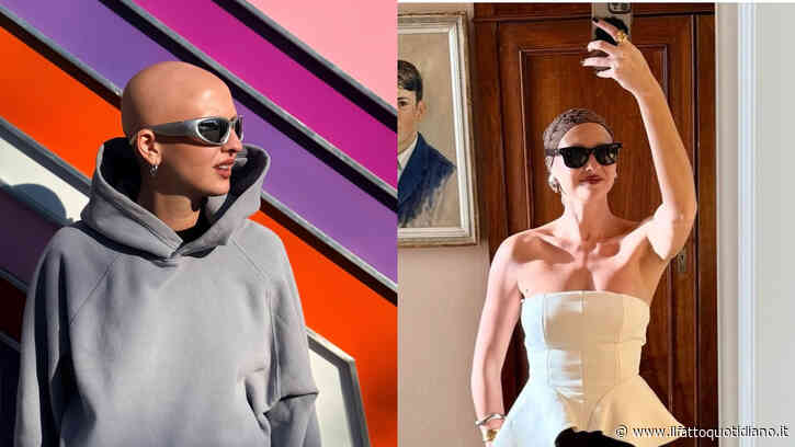 “Ho l’alopecia, ma non ho mai indossato parrucche. Dopo l’adolescenza ho sentito la necessità di mostrarmi”: la storia di Eugenia Longo