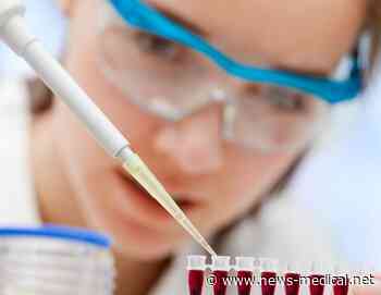 FDA clears innovative blood test for earlier Alzheimer's diagnosis