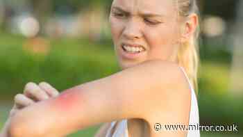 Heatwaves' sting in the tail as insect bites soar during hot weather