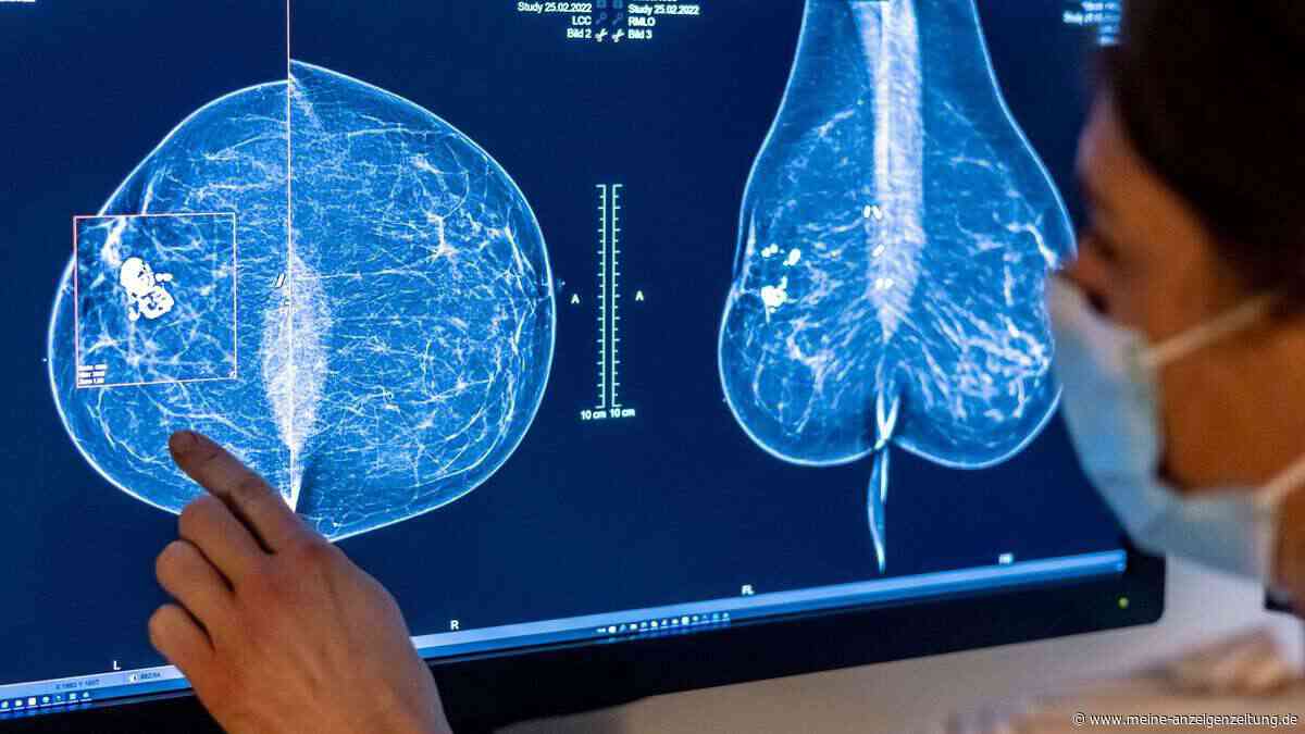 Forscher testen neue Behandlungsmethode für Brustkrebs