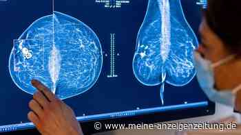 Forscher testen neue Behandlungsmethode für Brustkrebs