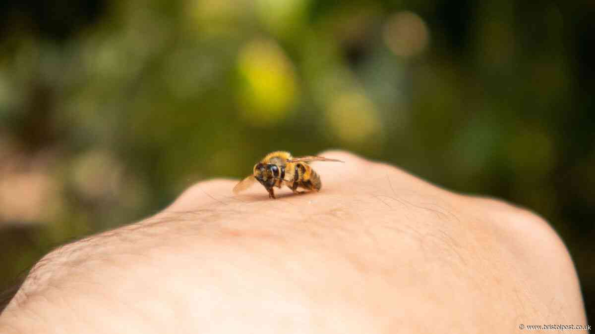 Wasp and bee sting symptoms you should not ignore explained by nurse