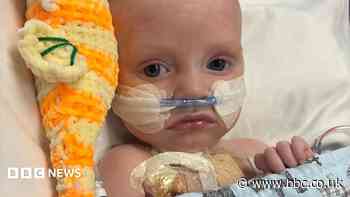 Baby whose parents feared had just days to live is 'thriving' after life-saving heart operation