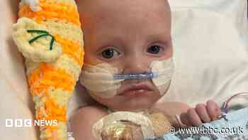 Baby whose parents feared had just days to live is 'thriving' after life-saving heart operation